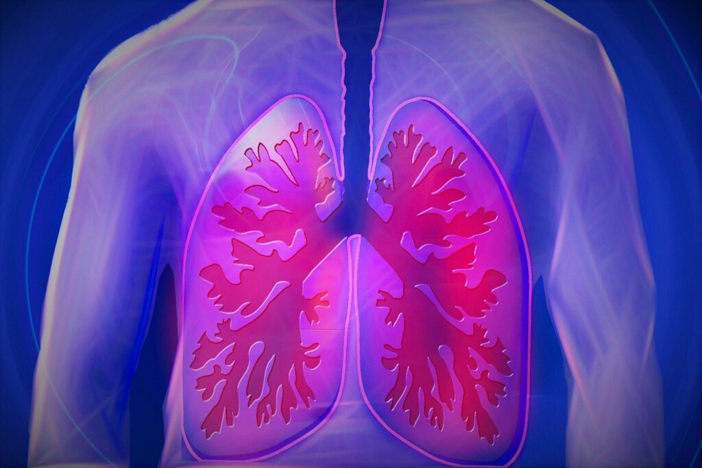 Trapianto polmoni e mesotelioma