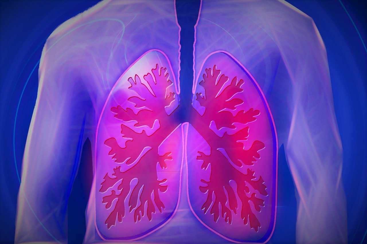 Scopri di più sull'articolo Mesotelioma: nuovo studio conferma vertiginoso aumento negli USA