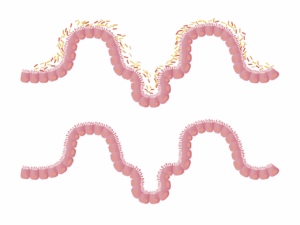 Scopri di più sull'articolo Come il microbiota modella il sistema immunitario