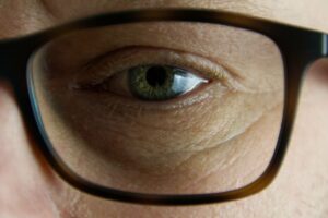 Scopri di più sull'articolo Retinopatia, il 30% di chi ne soffre ha il diabete