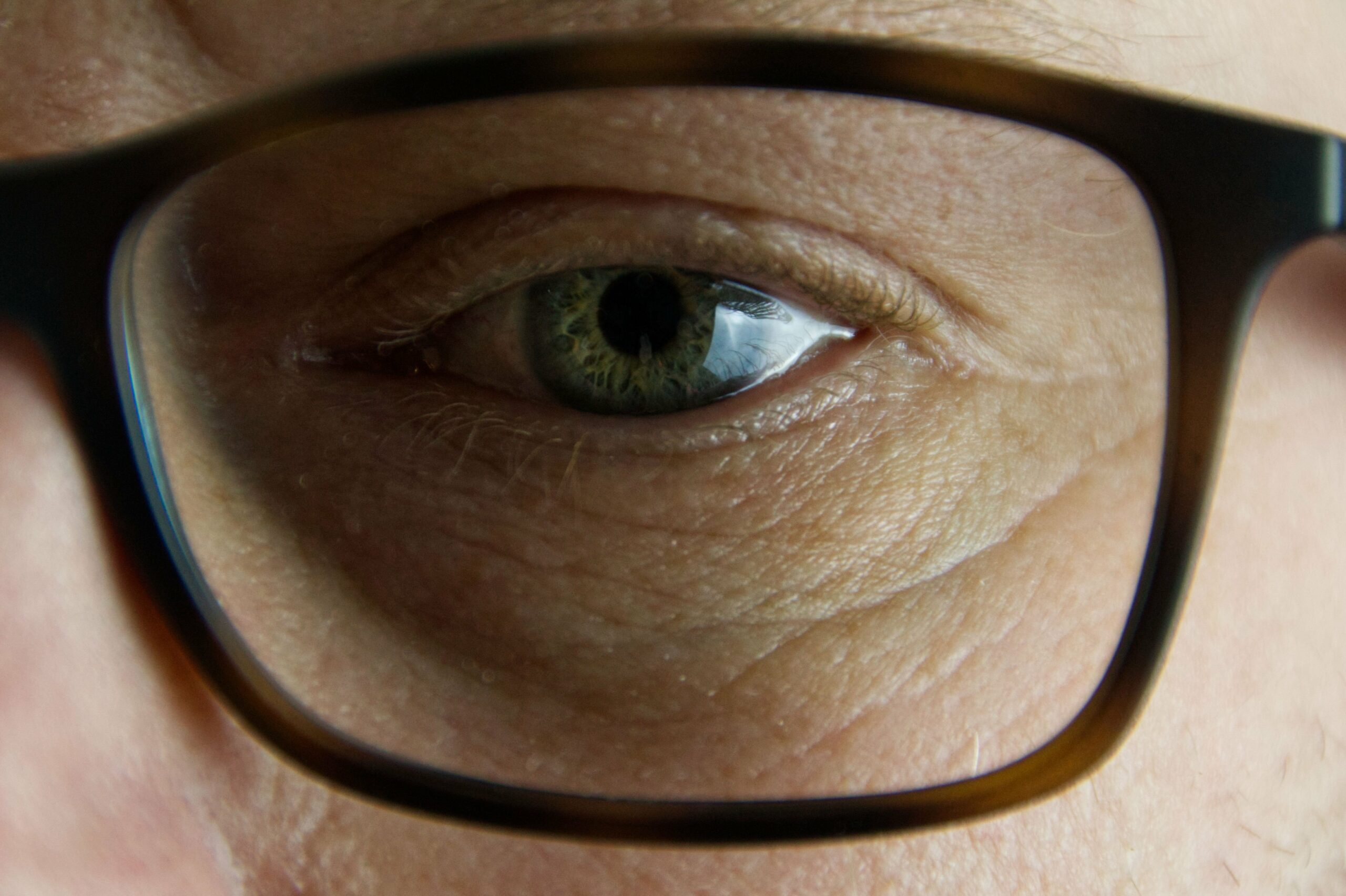 Scopri di più sull'articolo Retinopatia, il 30% di chi ne soffre ha il diabete